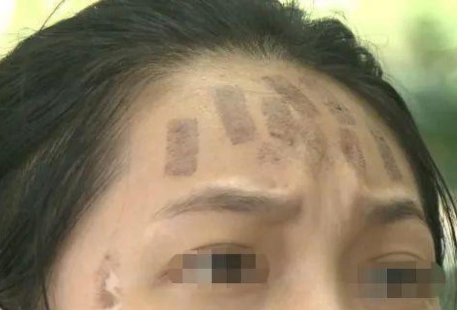 成都光子嫩膚價格，科技重塑肌膚之美